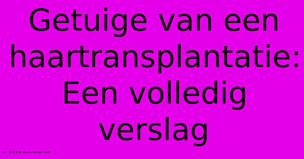 Getuige Van Een Haartransplantatie: Een Volledig Verslag