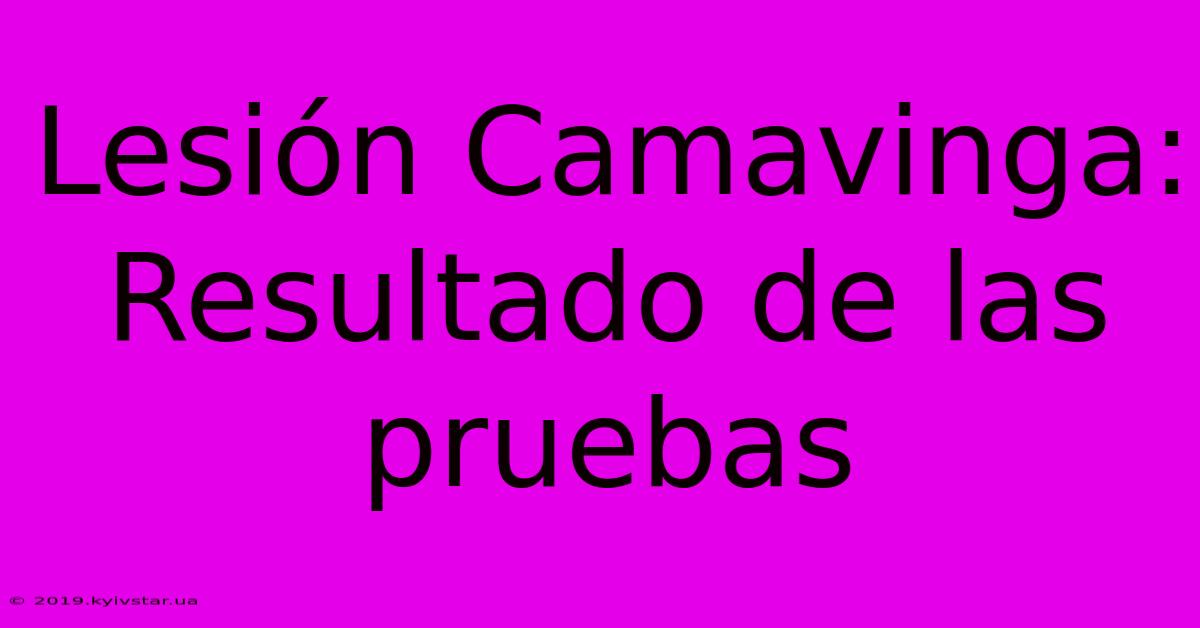 Lesión Camavinga: Resultado De Las Pruebas